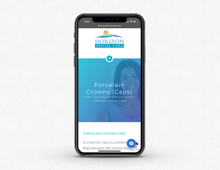 Horizon Dental Website - Mobile Device